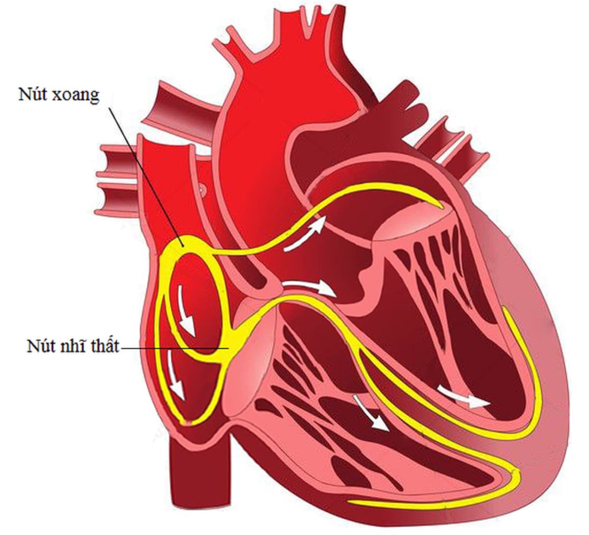 Suy nút xoang tim: Nguyên nhân, triệu chứng và điều trị