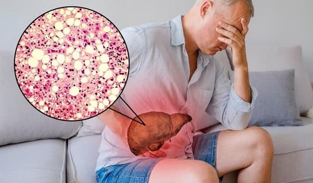 Thói quen sinh hoạt lành mạnh giúp làm giảm men gan cao