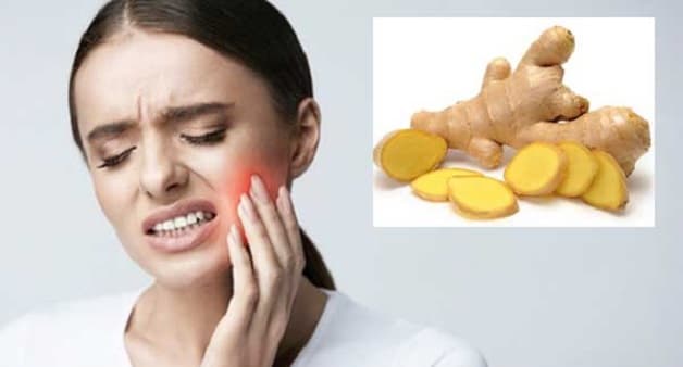Gừng là loại thực phẩm được sử dụng nhiều trong việc điều trị bệnh lý răng miệng trong đó có đau răng.