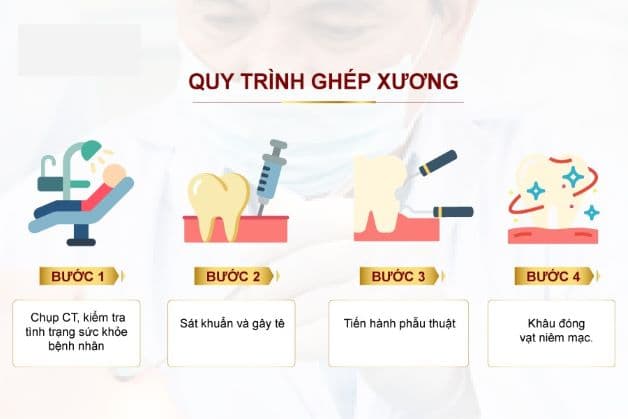 Để quá trình ghép xương diễn ra thuận lợi và thành công, các bác sĩ và các cơ sở nha khoa cần tuân thủ nghiêm ngặt quy trình đạt chuẩn.