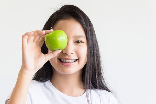 Thói quen ăn nhai không đúng là một trong những yếu tố đầu tiên dẫn đến tình trạng má bị hóp trong quá trình chỉnh nha.