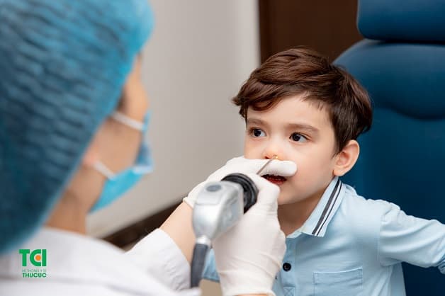 polyp mũi có tái phát không