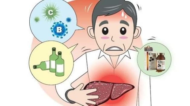 Tăng men gan là hậu quả của việc các tế bào gan bị tổn thương