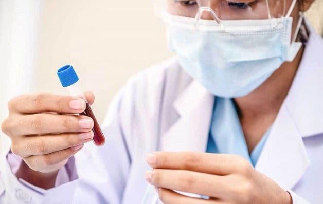 Xét nghiệm viêm gan A cần thực hiện như thế nào?