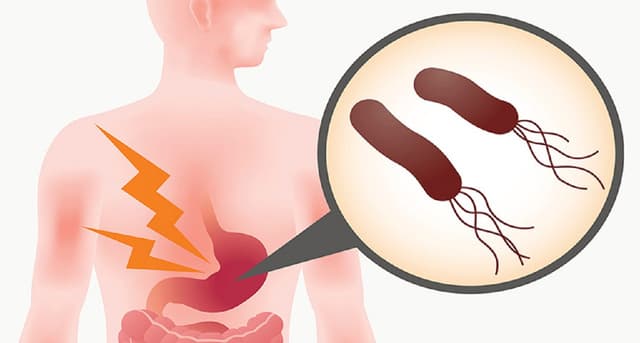 Vi khuẩn Hp gây ra bệnh gì? Có nguy hiểm không?