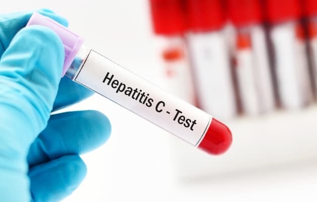 Thường xuyên tham khám y tế để sớm phát hiện bệnh viêm gan và điều trị kịp thời