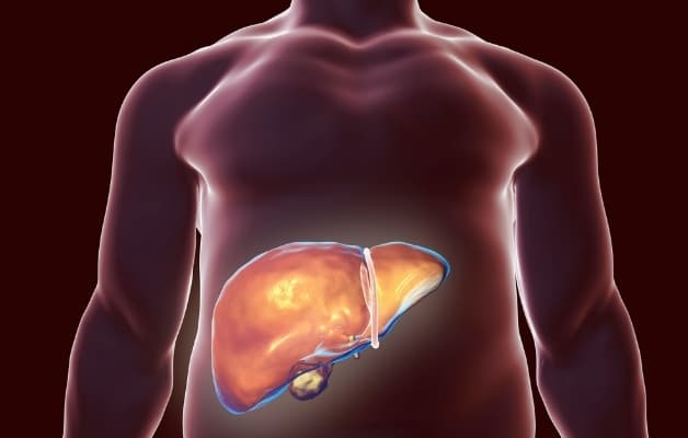 Viêm gan tự miễn, mối lo của nhiều bệnh nhân