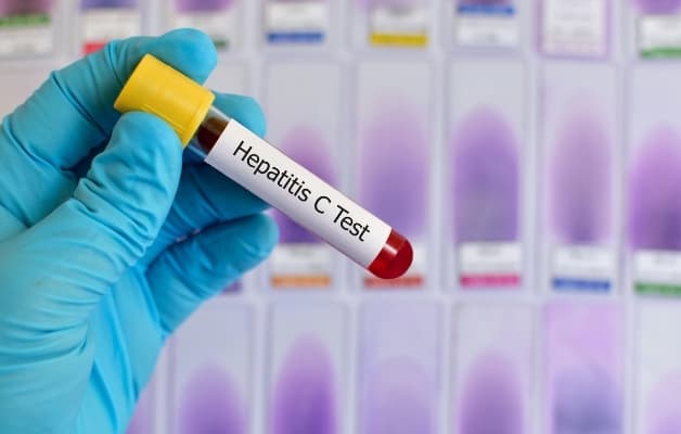 Mỗi loại viêm gan virus có những cách điều trị nhất định