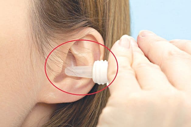 điều trị Viêm tai giữa vỡ mủ