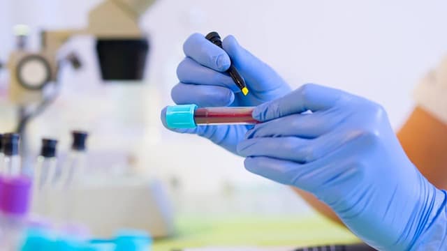 3 xét nghiệm miễn dịch phổ biến trong tầm soát ung thư