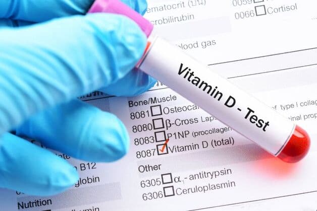 xét nghiệm vitamin D ở đâu