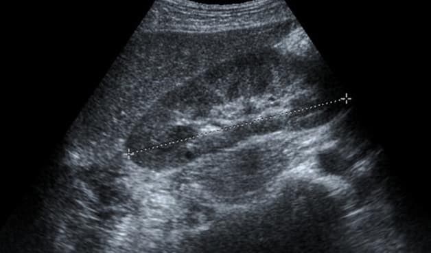 Siêu âm là phương pháp chẩn đoán bệnh chính xác cao.