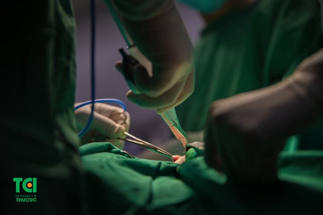 Phẫu thuật ung thư tuyến giáp tại Bệnh viện Thu Cúc