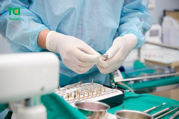 Bảng giá trồng răng implant với các thương hiệu khác nhau sẽ có những chi phí khác nhau