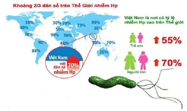 Ước tính có khoảng trên 70% dân số Việt Nam có vi khuẩn Hp trong dạ dày