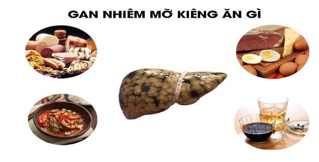 Gan nhiễm mỡ kiêng gì