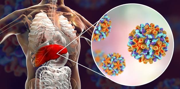 Phác đồ điều trị viêm gan B của Bộ Y tế khác nhau đối với trường hợp cấp tính và mạn tính