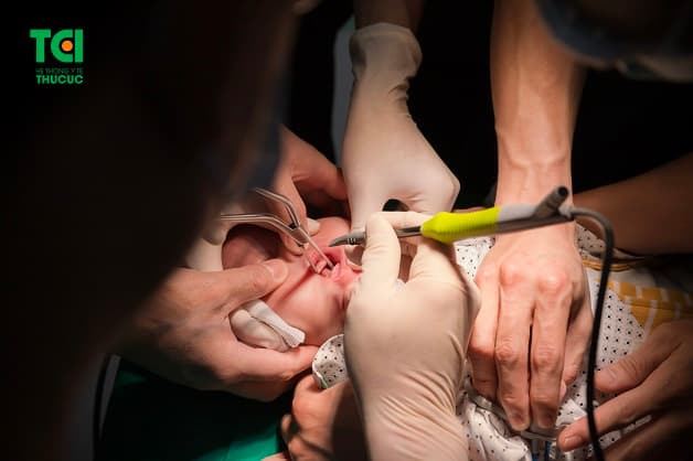 Em bé thực hiện cắt thắng lưỡi tại BV ĐKQT Thu Cúc