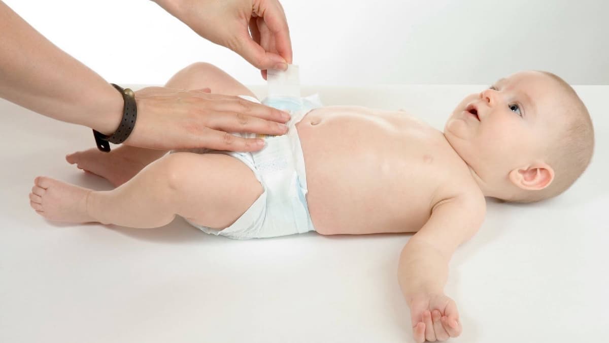 Trẻ sơ sinh bị sỏi bụng đi ngoài: Nguyên nhân & điều trị