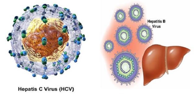 Bệnh viêm gan C do virus HCV gây ra