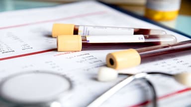 Ung thư tụy xét nghiệm máu: CA 19-9 có ý nghĩa gì?