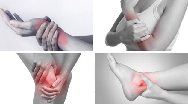 hình ảnh viêm xương khớp