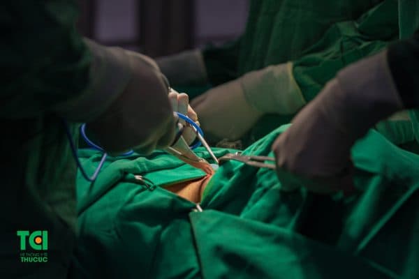 tìm hiểu mổ u tuyến giáp ở bệnh viện nào tốt nhất