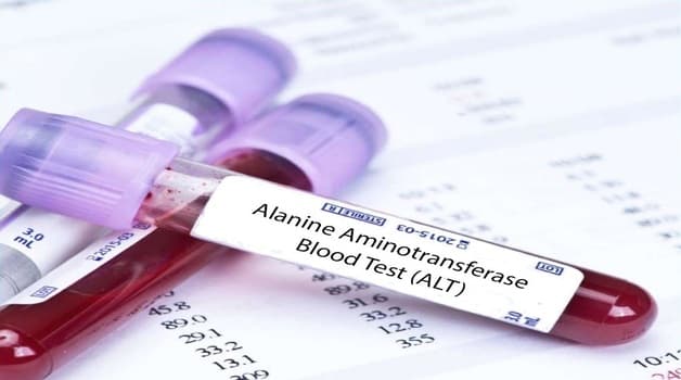 Các xét nghiệm về gan mật: ALT là chỉ số hay dùng đánh giá chức năng gan