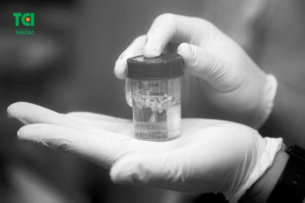 5 bước tiến hành hút chân không u vú 