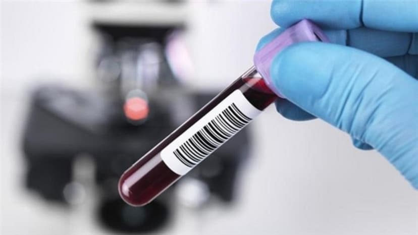 Có bao nhiêu phương pháp xét nghiệm suy buồng trứng?