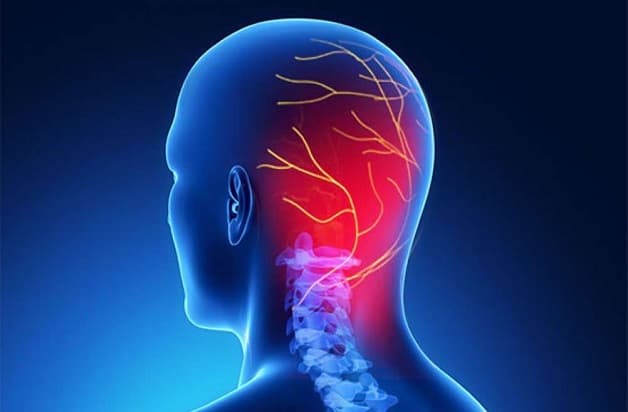 đau nửa đầu phía sau bên phải