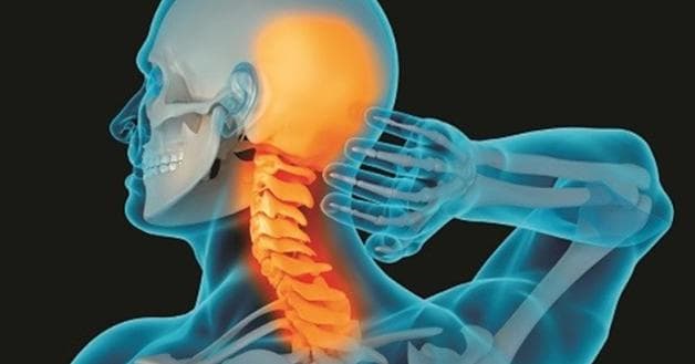 Đau nửa đầu sau phải là dấu hiệu của bệnh thoái hóa đốt sống cổ