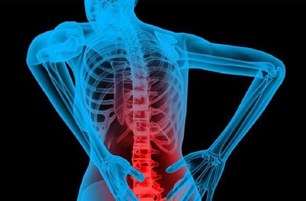 Đau nửa đầu sau phải là dấu hiệu của bệnh lao xương khớp