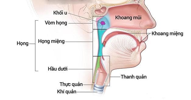 Điều trị ung thư vòm họng giai đoạn đầu bằng hóa trị