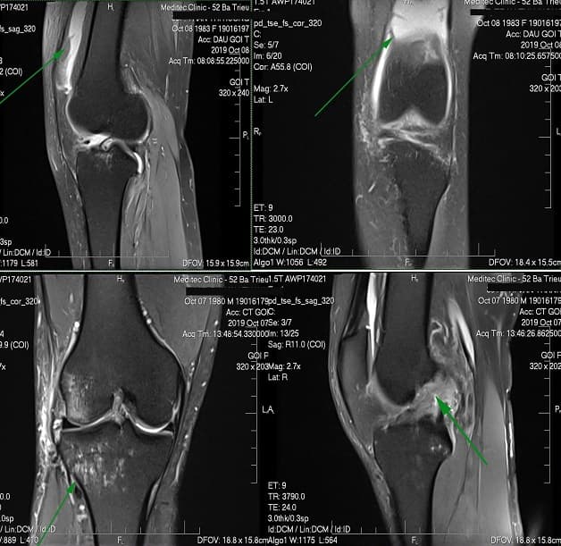 Kết quả chụp MRI cho thấy những hình ảnh rõ nét ở từng vùng chụp