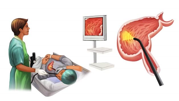 Nội soi dạ dày đại tràng ở đâu tốt nhất