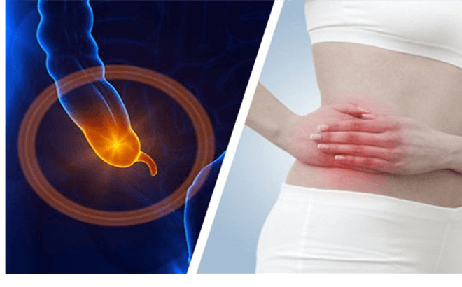 Thời gian ủ bệnh viêm ruột thừa cần nhớ