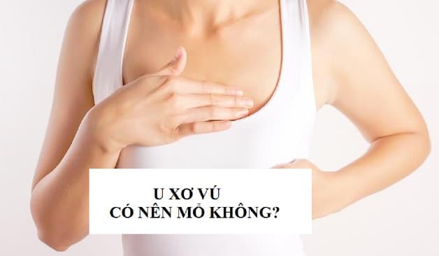 u xơ vú có nên mổ không là câu hỏi mà nhiều người bệnh muốn giải đáp