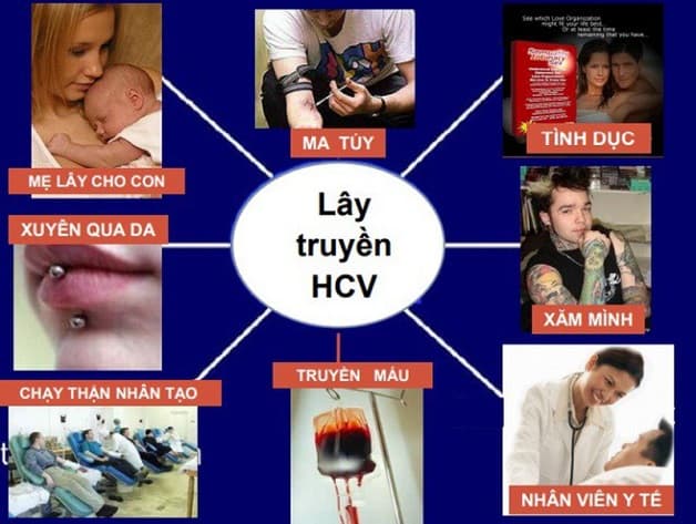 viêm gan C lây qua đường nào - 3 con đường chính