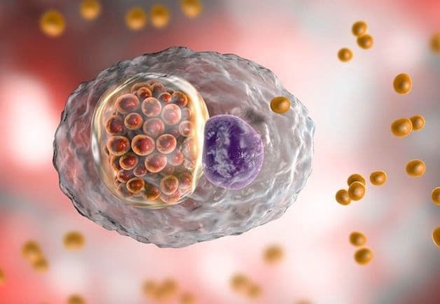 Viêm kết mạc kéo dài có thể do vi khuẩn Chlamydia.