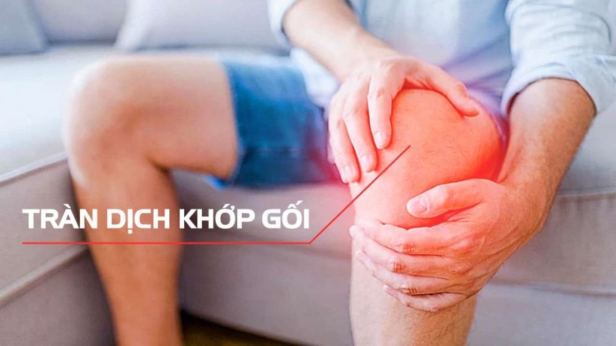 Viêm khớp gối tràn dịch là gì? Có nguy hiểm không
