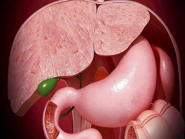 Đa polyp túi mật có nguy hiểm không