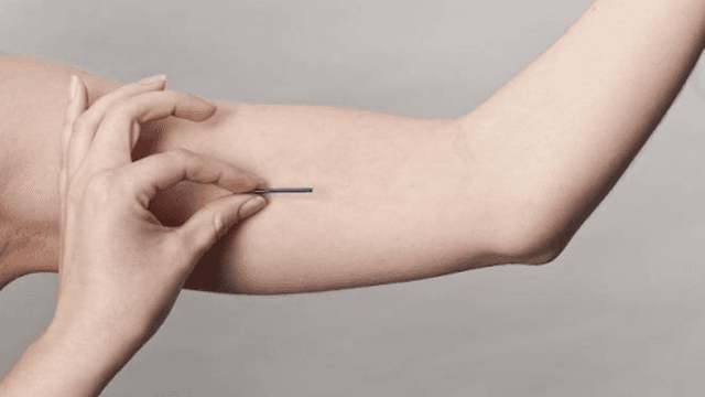 Chị em nên lựa chọn cấy que tránh thai ở đâu tốt nhất?