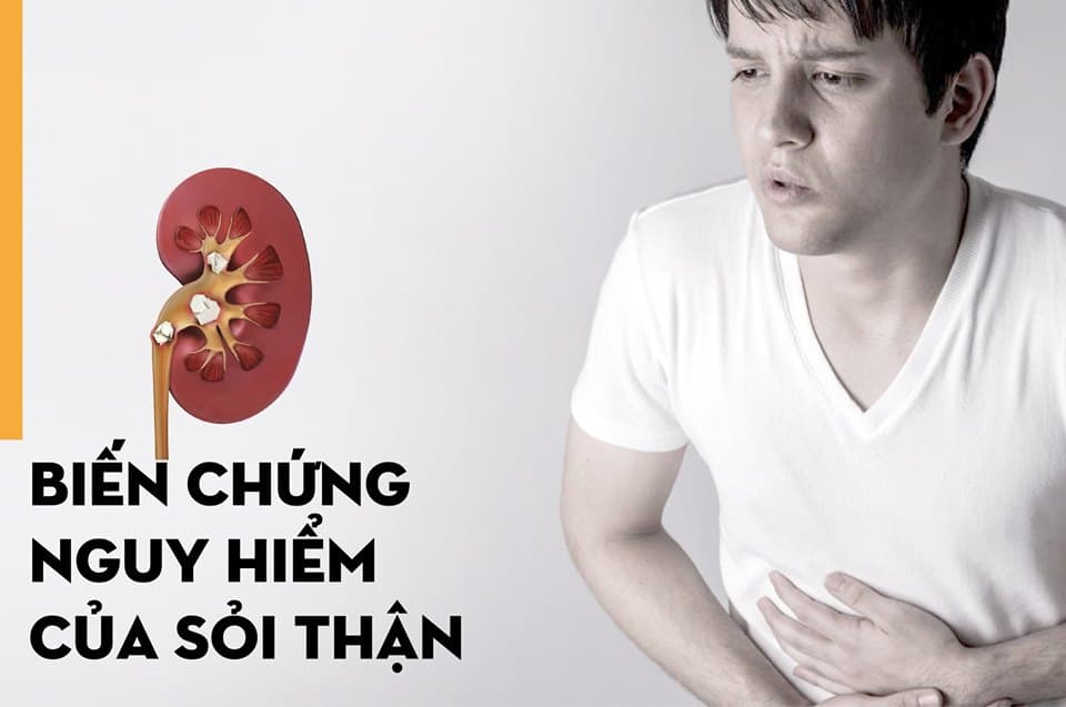 Bác sĩ chữa sỏi thận giỏi ở đâu