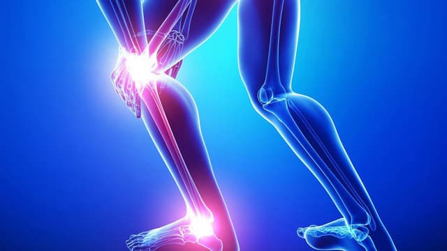 Dấu hiệu thoái hóa khớp gối qua các giai đoạn