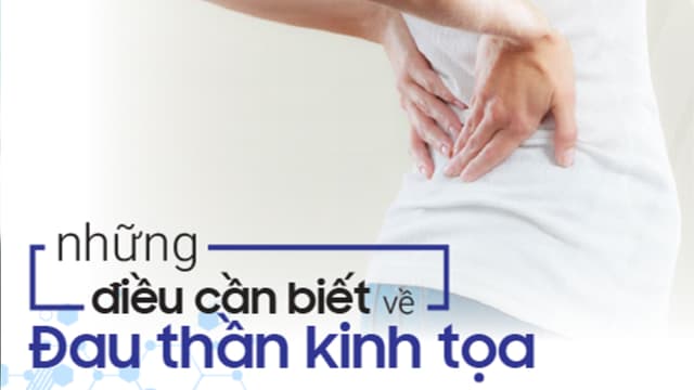 Đau thần kinh tọa và những điều cần biết