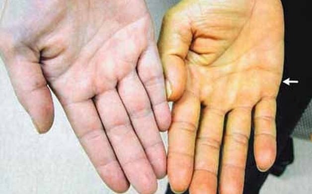 khám bệnh viêm gan B ở đâu và khi nào cần khám