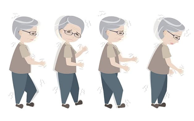 nguyên nhân bị bệnh Parkinson phổ biến