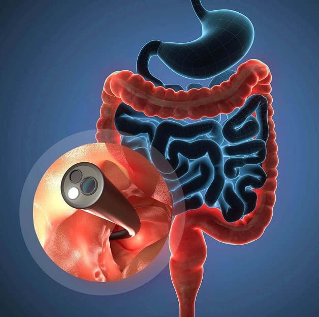 Tìm hiểu nội soi tiêu hóa ở đâu tốt