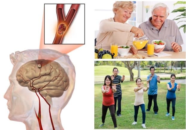 Thực hiện và đảm bảo duy trì thói quen sinh hoạt lành mạnh, có lợi sẽ giúp ngăn ngừa các triệu chứng tai biến mạch máu não